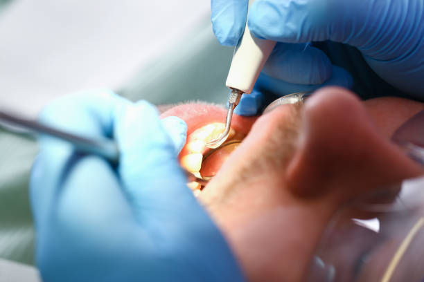 Tooth Infection Emergency Dentist in AL